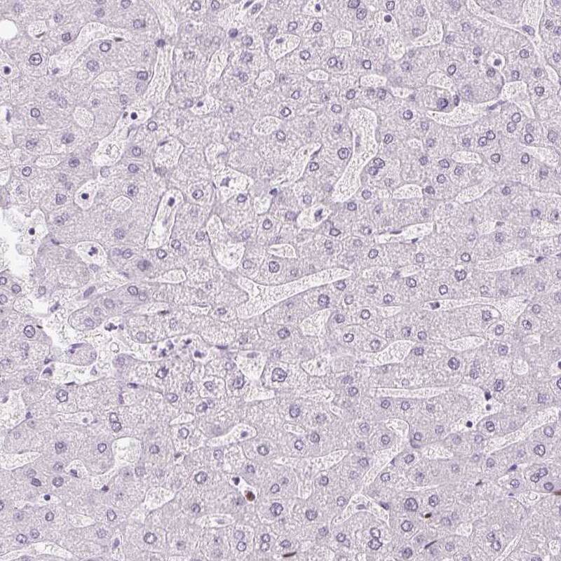 ZEB1 Antibody (CL0151) - Azide and BSA Free Immunohistochemistry-Paraffin: ZEB1 Antibody [NBP3-43907]