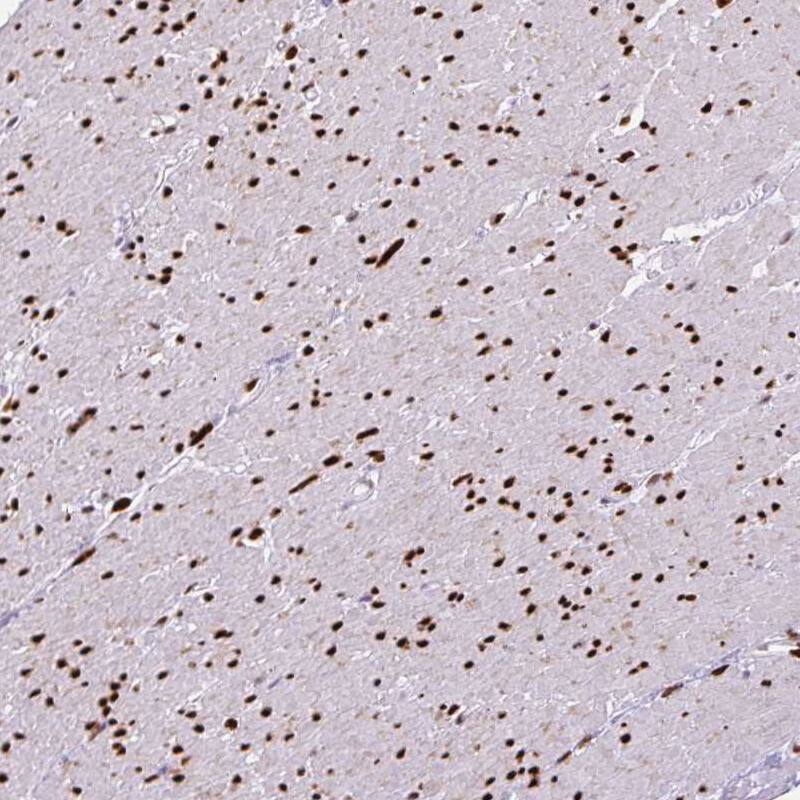 ZEB1 Antibody (CL0151) - Azide and BSA Free Immunohistochemistry-Paraffin: ZEB1 Antibody [NBP3-43907]