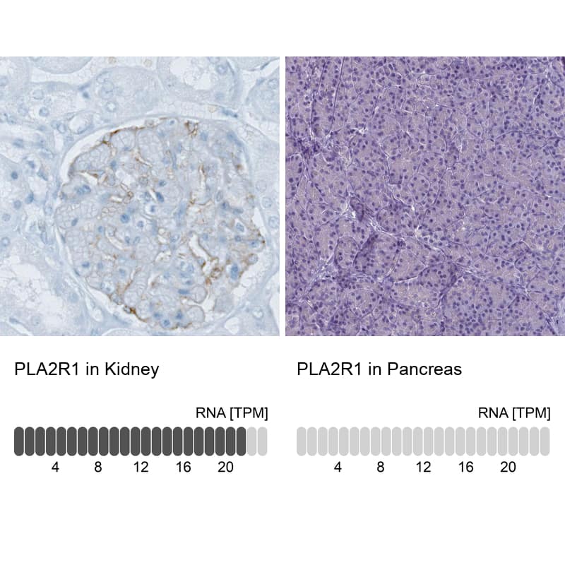 PLA2R1 Antibody (CL0474) - Azide and BSA Free Immunohistochemistry-Paraffin: PLA2R1 Antibody [NBP3-43909]