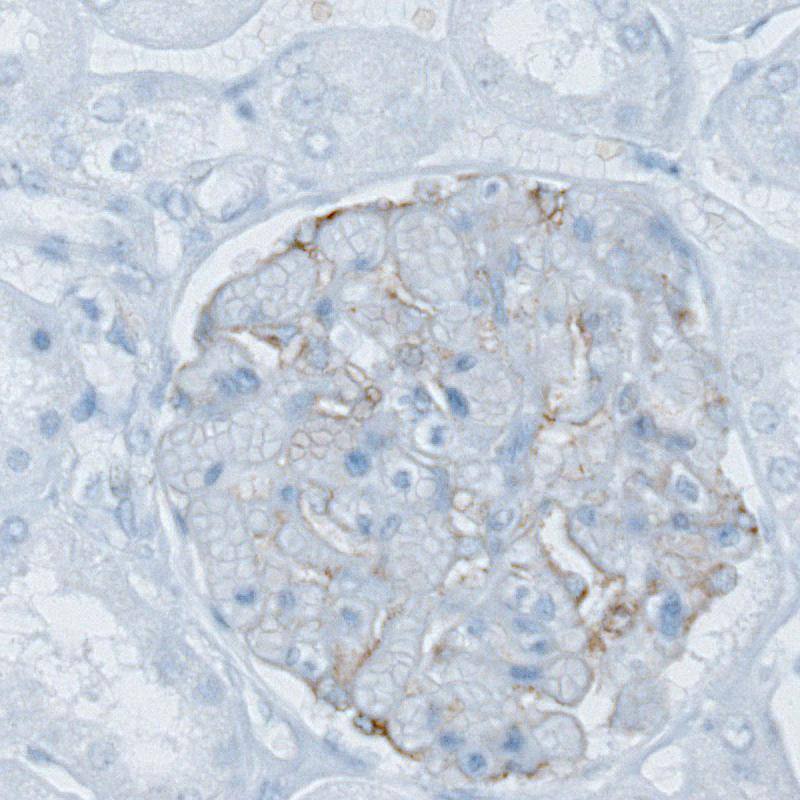 PLA2R1 Antibody (CL0474) - Azide and BSA Free Immunohistochemistry-Paraffin: PLA2R1 Antibody [NBP3-43909]
