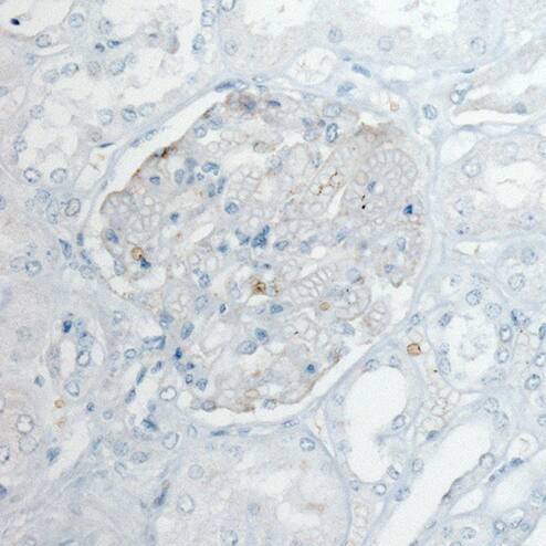 PLA2R1 Antibody (CL0485) - Azide and BSA Free Immunohistochemistry-Paraffin: PLA2R1 Antibody [NBP3-43910]