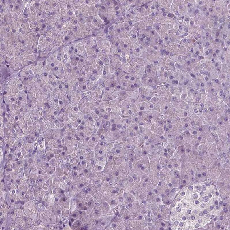 PLA2R1 Antibody (CL0485) - Azide and BSA Free Immunohistochemistry-Paraffin: PLA2R1 Antibody [NBP3-43910]