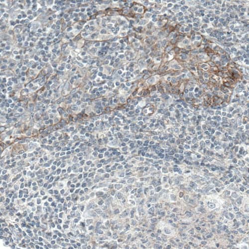 EGFR Antibody (CL0815) - Azide and BSA Free Immunohistochemistry-Paraffin: EGFR Antibody [NBP3-43911]