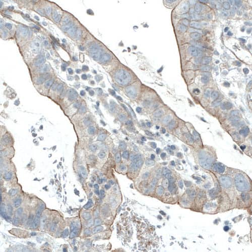 EGFR Antibody (CL0815) - Azide and BSA Free Immunohistochemistry-Paraffin: EGFR Antibody [NBP3-43911]