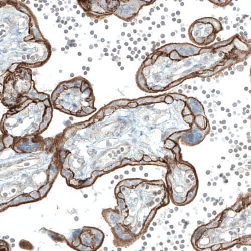EGFR Antibody (CL0815) - Azide and BSA Free Immunohistochemistry-Paraffin: EGFR Antibody [NBP3-43911]