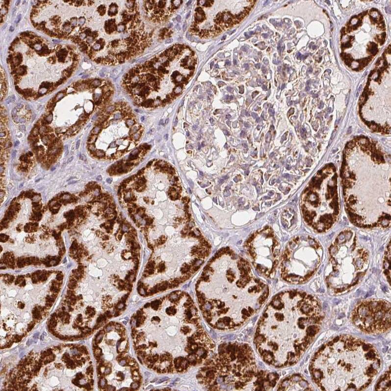 SDHB Antibody (CL0346) - Azide and BSA Free Immunohistochemistry-Paraffin: SDHB Antibody [NBP3-43913]