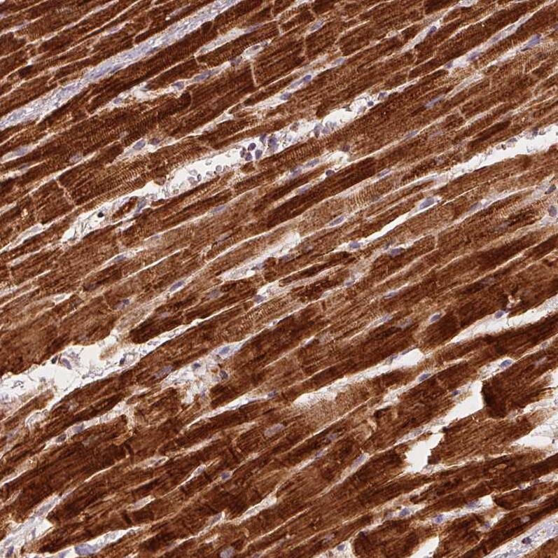 SDHB Antibody (CL0346) - Azide and BSA Free Immunohistochemistry-Paraffin: SDHB Antibody [NBP3-43913]