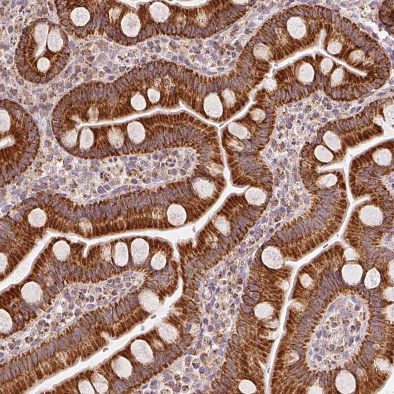 SDHB Antibody (CL0346) - Azide and BSA Free Immunohistochemistry-Paraffin: SDHB Antibody [NBP3-43913]