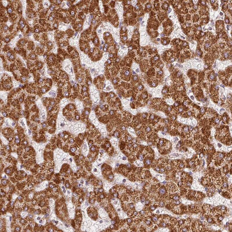 SDHB Antibody (CL0346) - Azide and BSA Free Immunohistochemistry-Paraffin: SDHB Antibody [NBP3-43913]