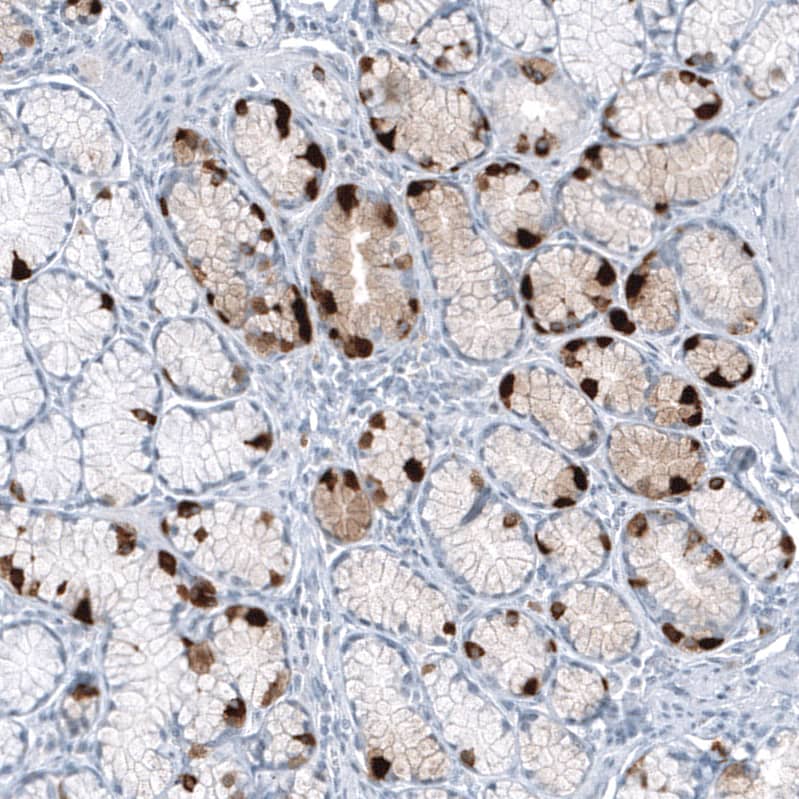 Chromogranin B Antibody (CL11393) - Azide and BSA Free Immunohistochemistry-Paraffin: Chromogranin B Antibody [NBP3-43914]