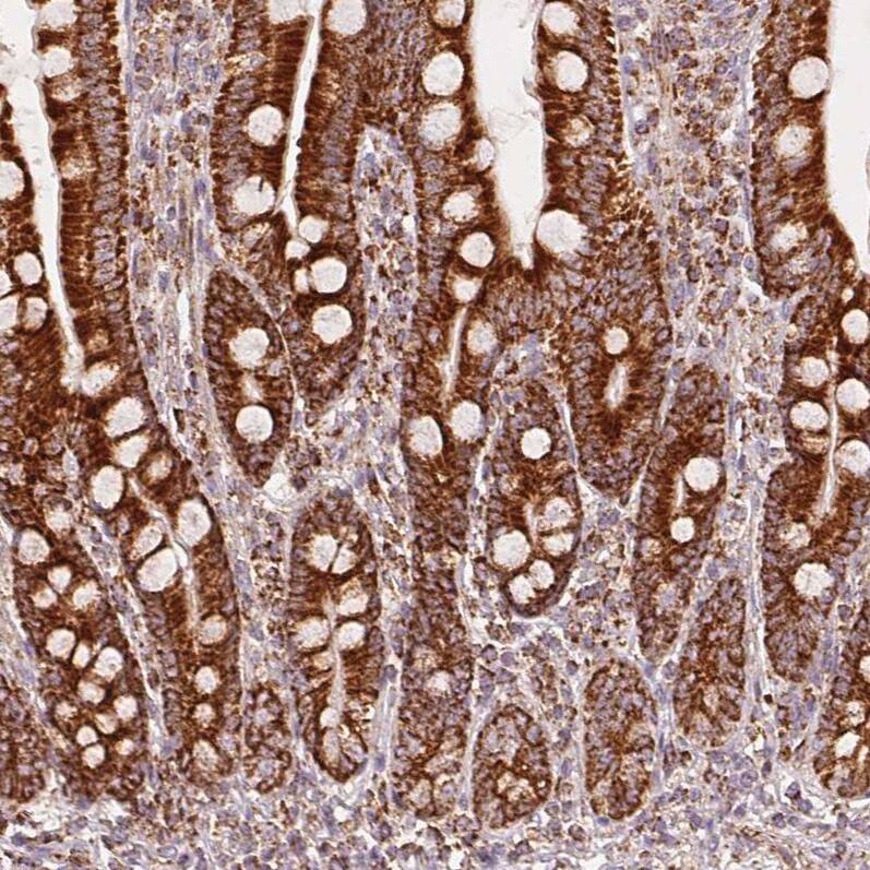 SDHB Antibody (CL0347) - Azide and BSA Free Immunohistochemistry-Paraffin: SDHB Antibody [NBP3-43915]