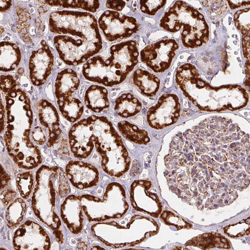 SDHB Antibody (CL0347) - Azide and BSA Free Immunohistochemistry-Paraffin: SDHB Antibody [NBP3-43915]