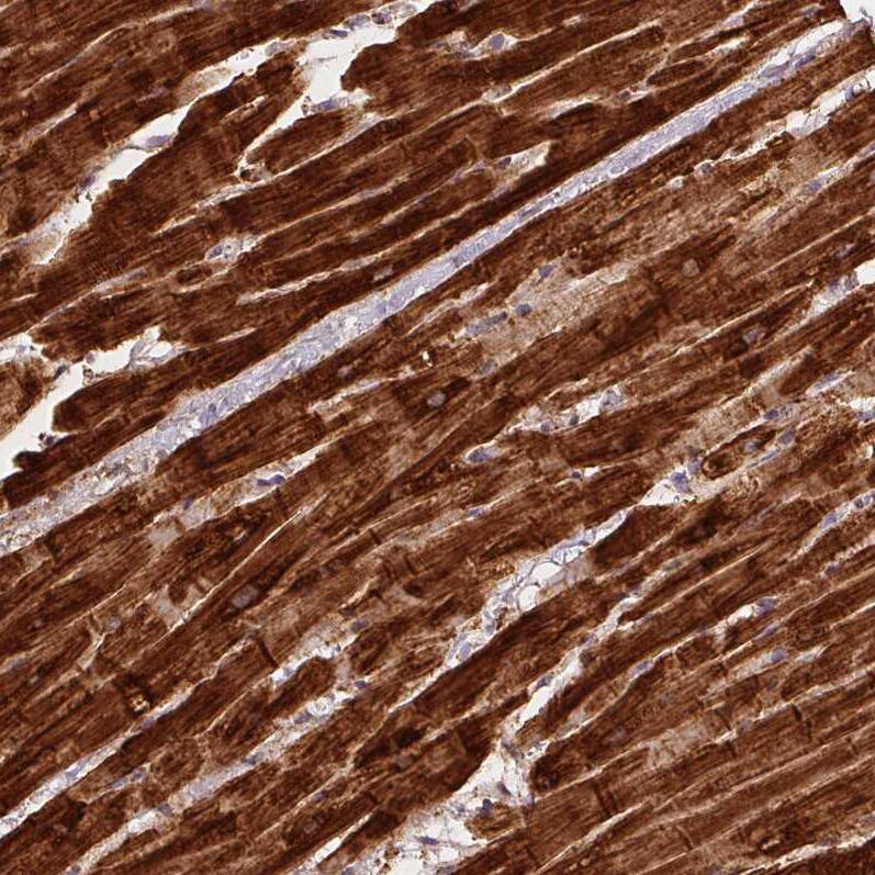 SDHB Antibody (CL0347) - Azide and BSA Free Immunohistochemistry-Paraffin: SDHB Antibody [NBP3-43915]