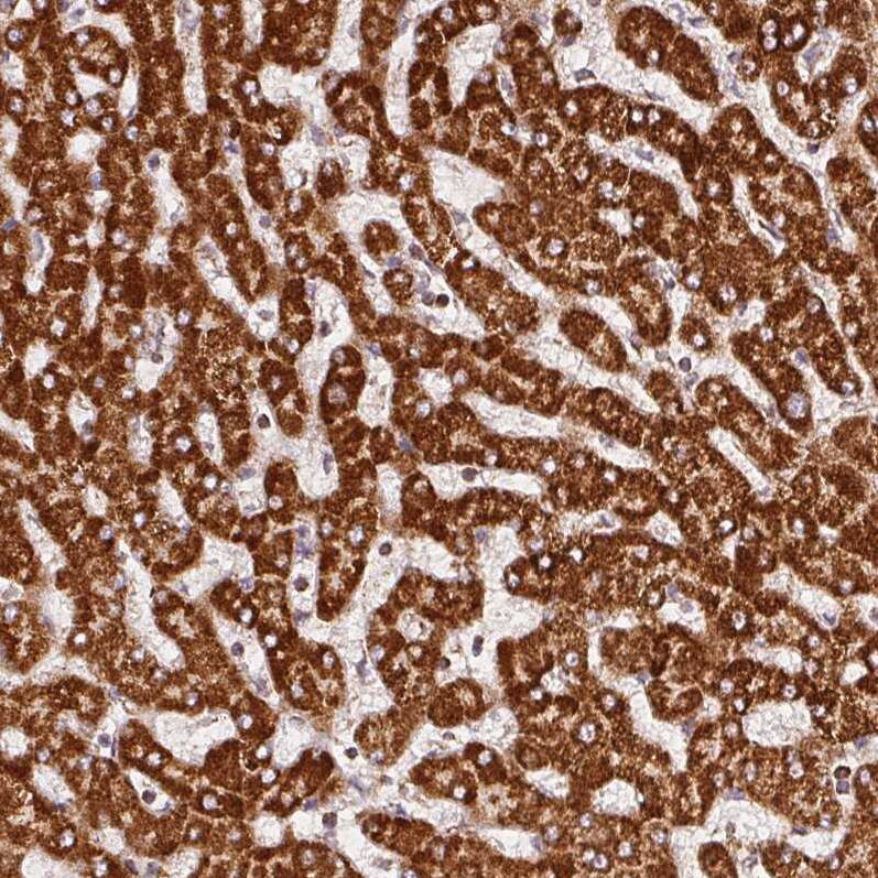 SDHB Antibody (CL0347) - Azide and BSA Free Immunohistochemistry-Paraffin: SDHB Antibody [NBP3-43915]
