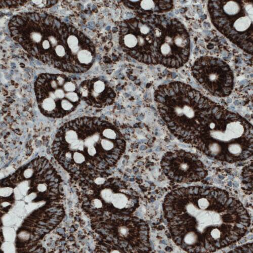 SDHB Antibody (CL0349) - Azide and BSA Free Immunohistochemistry-Paraffin: SDHB Antibody [NBP3-43917]