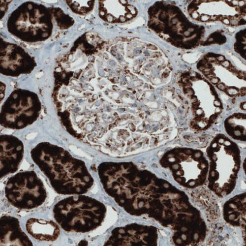 SDHB Antibody (CL0349) - Azide and BSA Free Immunohistochemistry-Paraffin: SDHB Antibody [NBP3-43917]
