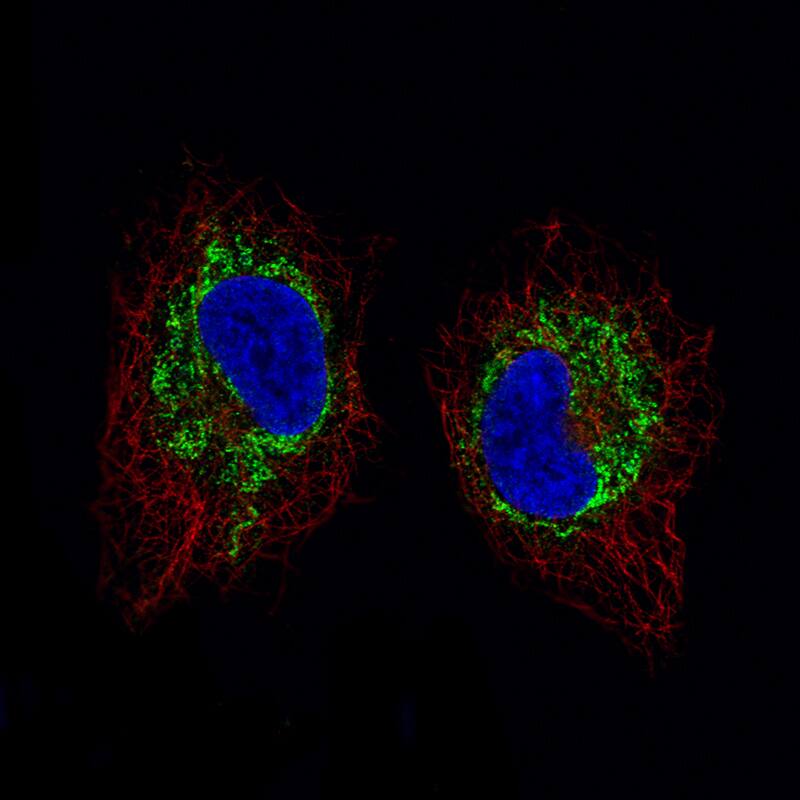 SDHB Antibody (CL0349) - Azide and BSA Free Immunocytochemistry/ Immunofluorescence: SDHB Antibody [NBP3-43917]