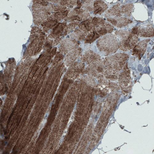 SDHB Antibody (CL0349) - Azide and BSA Free Immunohistochemistry-Paraffin: SDHB Antibody [NBP3-43917]