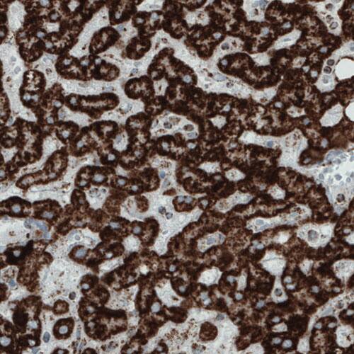 SDHB Antibody (CL0349) - Azide and BSA Free Immunohistochemistry-Paraffin: SDHB Antibody [NBP3-43917]