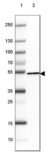 Hsp70 interacting protein HIP Antibody (CL3708) - Azide and BSA Free Western Blot: Hsp70 interacting protein HIP Antibody [NBP3-43918]