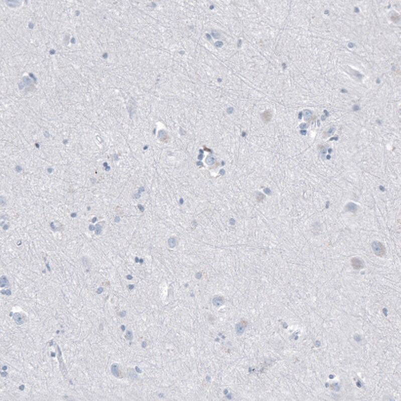 CD20 Antibody (CL10613) - Azide and BSA Free Immunohistochemistry-Paraffin: CD20 Antibody [NBP3-43919]