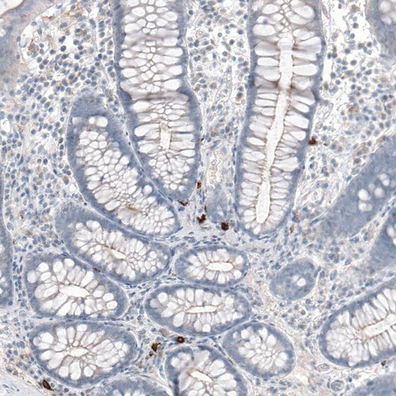 CD20 Antibody (CL10613) - Azide and BSA Free Immunohistochemistry-Paraffin: CD20 Antibody [NBP3-43919]