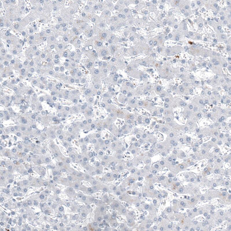 CD20 Antibody (CL10613) - Azide and BSA Free Immunohistochemistry-Paraffin: CD20 Antibody [NBP3-43919]