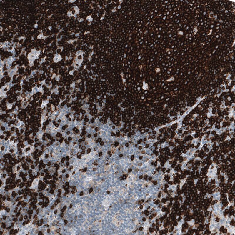 CD20 Antibody (CL10613) - Azide and BSA Free Immunohistochemistry-Paraffin: CD20 Antibody [NBP3-43919]
