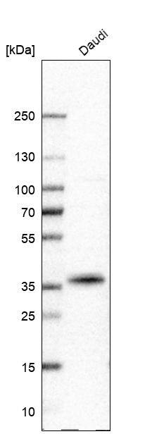 CD20 Antibody (CL10613) - Azide and BSA Free Western Blot: CD20 Antibody [NBP3-43919]