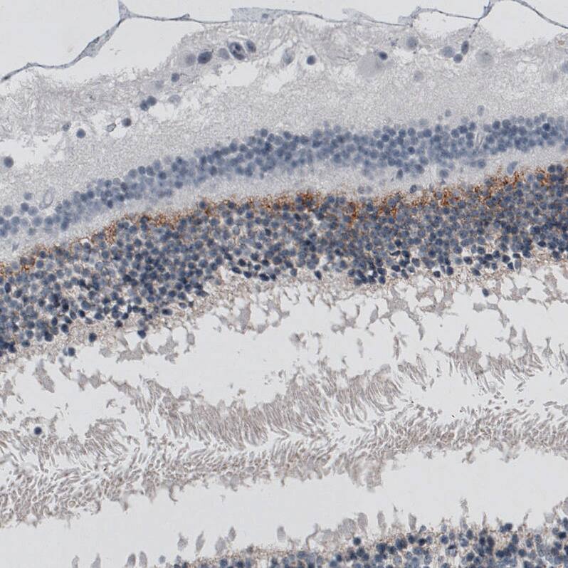 ANO2 Antibody (CL10632) - Azide and BSA Free Immunohistochemistry-Paraffin: ANO2 Antibody [NBP3-43920]