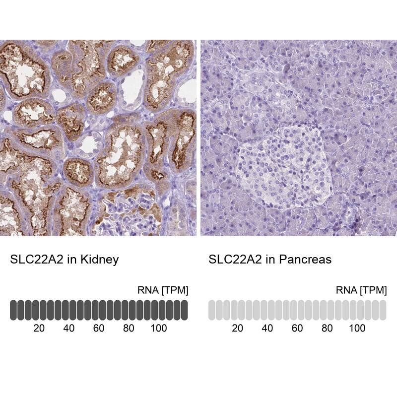 SLC22A2/OCT2 Antibody (CL0628) - Azide and BSA Free Immunohistochemistry-Paraffin: SLC22A2/OCT2 Antibody [NBP3-43921]