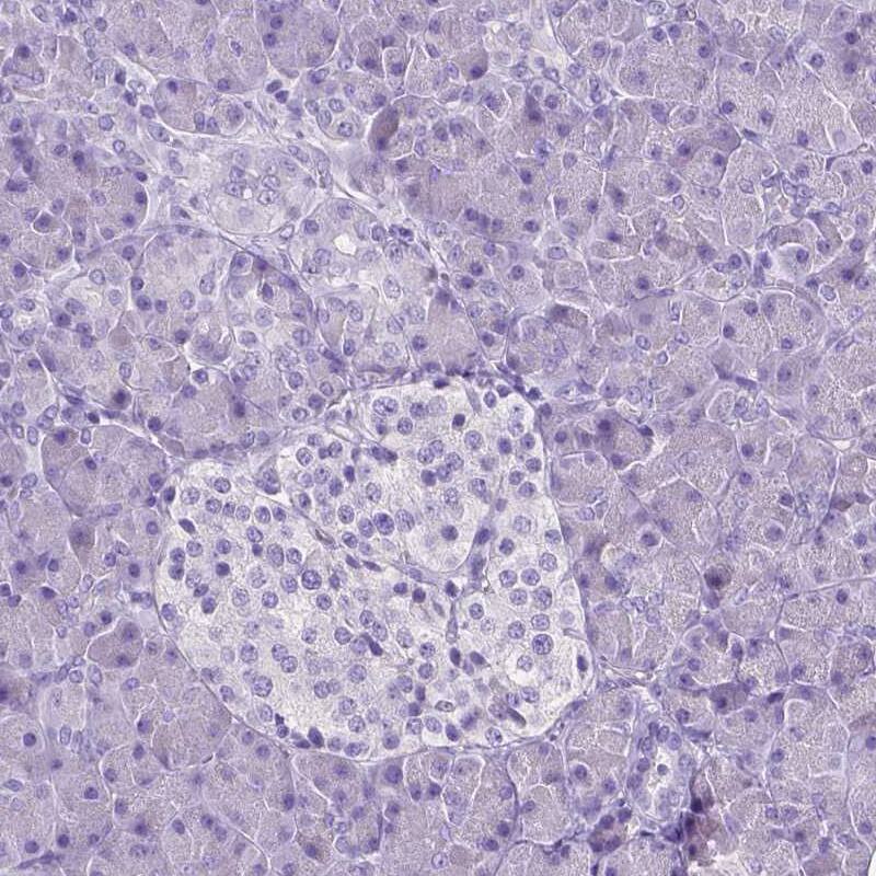 SLC22A2/OCT2 Antibody (CL0628) - Azide and BSA Free Immunohistochemistry-Paraffin: SLC22A2/OCT2 Antibody [NBP3-43921]
