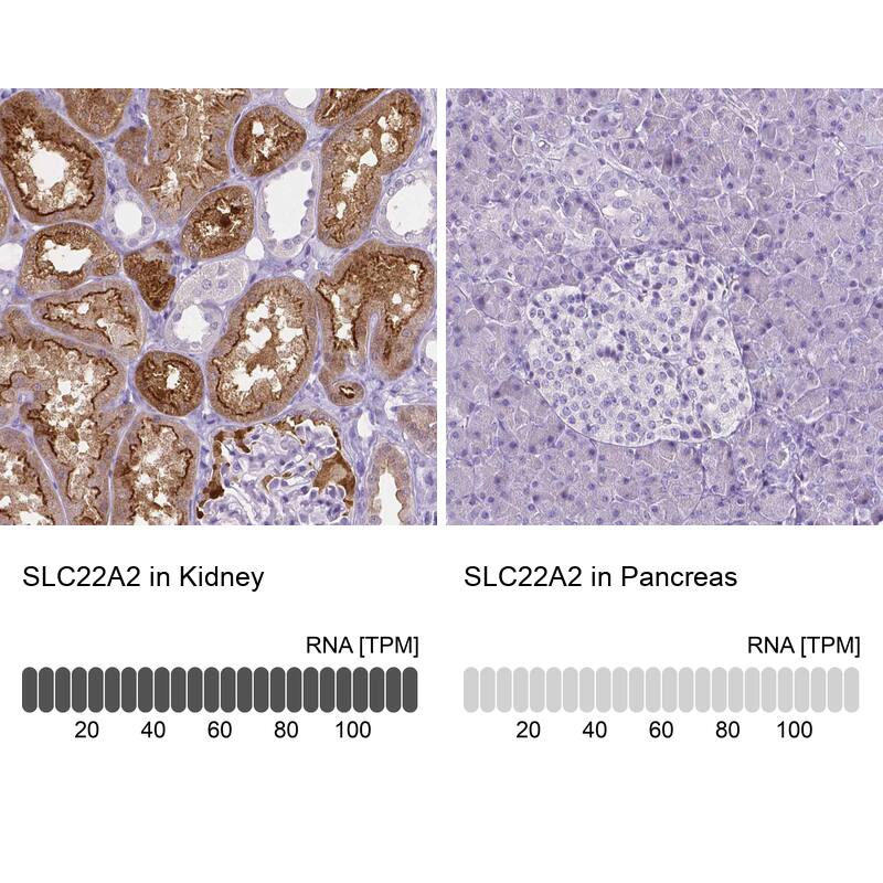 SLC22A2/OCT2 Antibody (CL0631) - Azide and BSA Free Immunohistochemistry-Paraffin: SLC22A2/OCT2 Antibody [NBP3-43922]