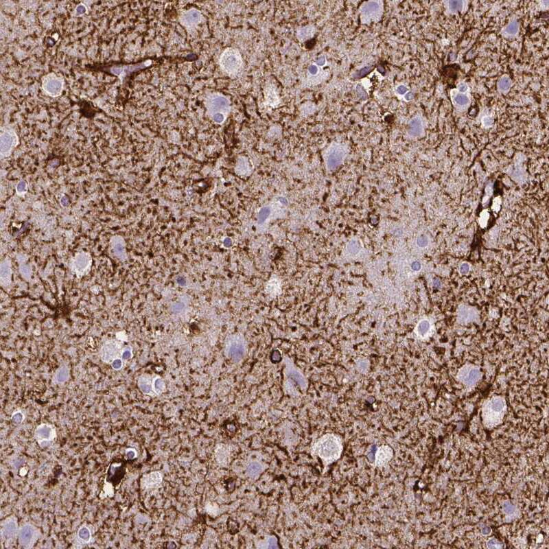SLC22A2/OCT2 Antibody (CL0631) - Azide and BSA Free Immunohistochemistry-Paraffin: SLC22A2/OCT2 Antibody [NBP3-43922]
