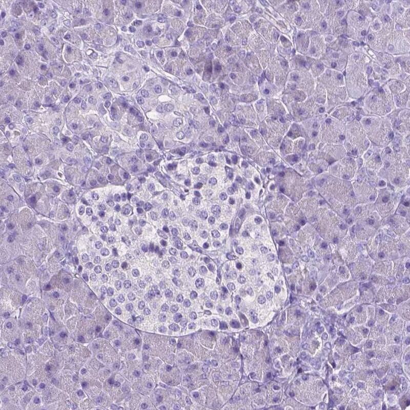 SLC22A2/OCT2 Antibody (CL0631) - Azide and BSA Free Immunohistochemistry-Paraffin: SLC22A2/OCT2 Antibody [NBP3-43922]