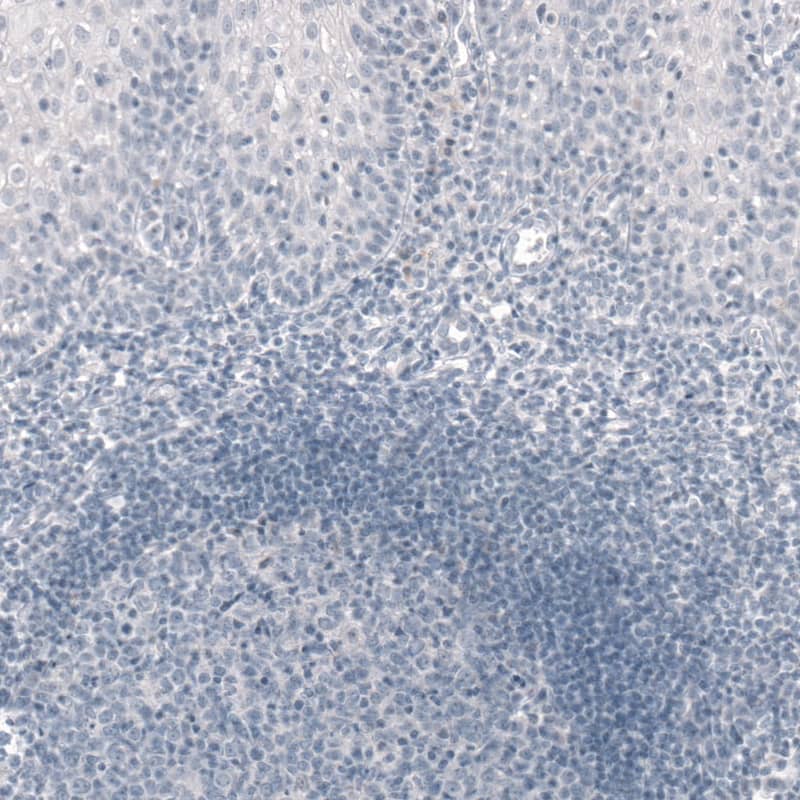 T-box 19 Antibody (CL6251) - Azide and BSA Free Immunohistochemistry-Paraffin: T-box 19 Antibody [NBP3-43923]