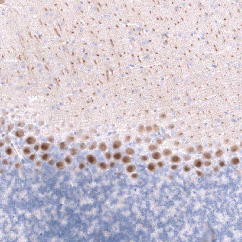 Calbindin D-28K Antibody (CL15065) - Azide and BSA Free Immunohistochemistry-Paraffin: Calbindin D-28K Antibody [NBP3-43925]