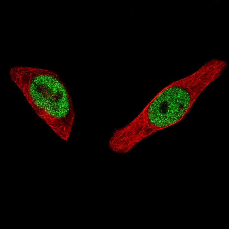ER alpha/NR3A1 Antibody (CL1196) - Azide and BSA Free Immunocytochemistry/ Immunofluorescence: ER alpha/NR3A1 Antibody [NBP3-43926]