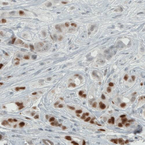 ER alpha/NR3A1 Antibody (CL1196) - Azide and BSA Free Immunohistochemistry-Paraffin: ER alpha/NR3A1 Antibody [NBP3-43926]
