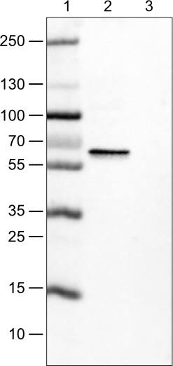 ER alpha/NR3A1 Antibody (CL1196) - Azide and BSA Free Western Blot: ER alpha/NR3A1 Antibody [NBP3-43926]