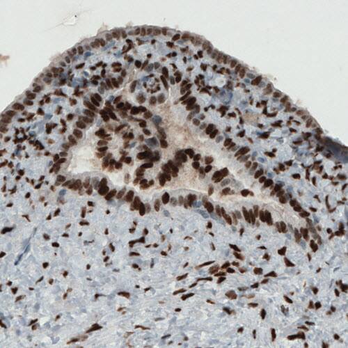 ER alpha/NR3A1 Antibody (CL1196) - Azide and BSA Free Immunohistochemistry-Paraffin: ER alpha/NR3A1 Antibody [NBP3-43926]
