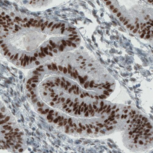 ER alpha/NR3A1 Antibody (CL1196) - Azide and BSA Free Immunohistochemistry-Paraffin: ER alpha/NR3A1 Antibody [NBP3-43926]