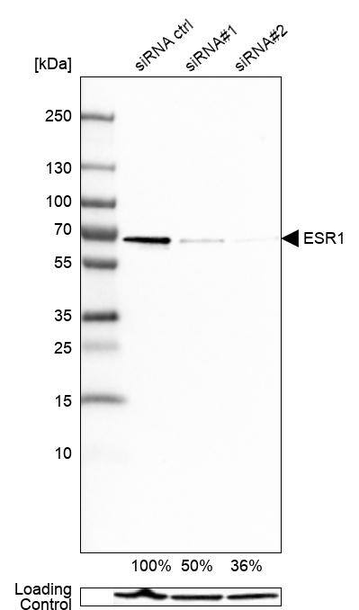 ER alpha/NR3A1 Antibody (CL1196) - Azide and BSA Free Western Blot: ER alpha/NR3A1 Antibody [NBP3-43926]