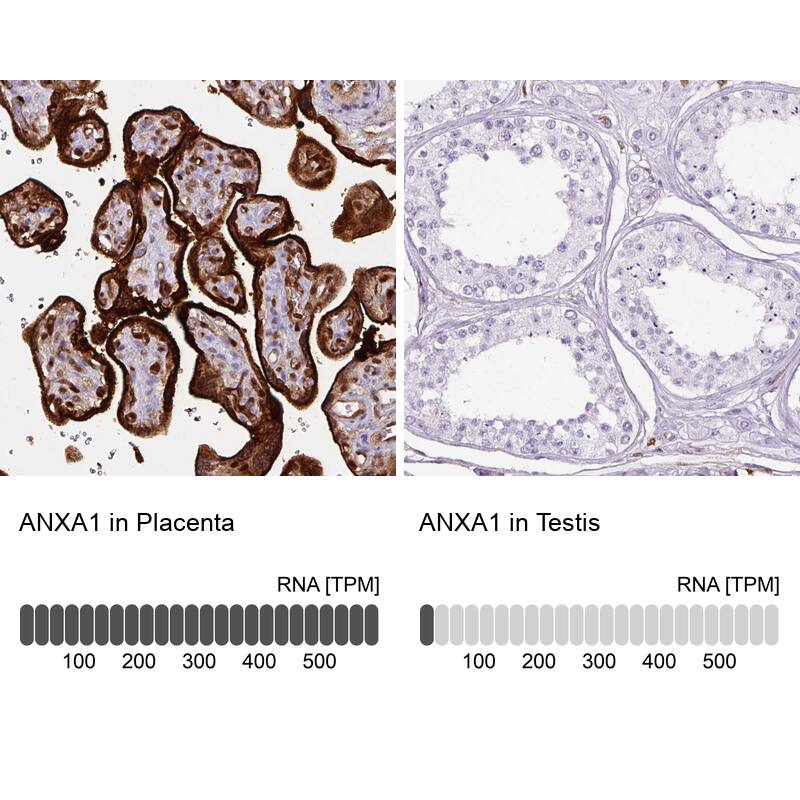 Annexin A1 Antibody (CL0199) - Azide and BSA Free Immunohistochemistry-Paraffin: Annexin A1 Antibody [NBP3-43928]