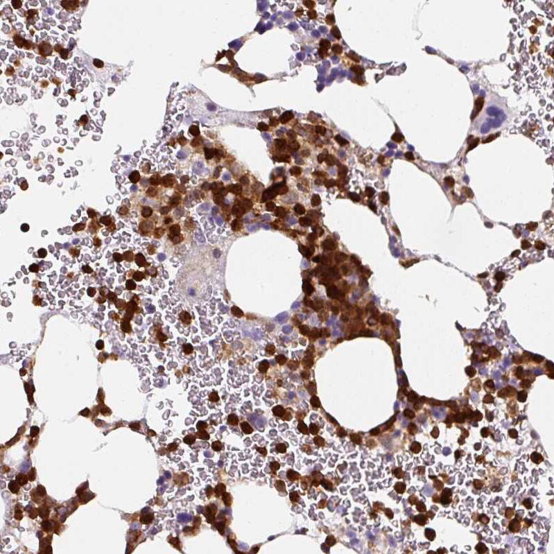 Annexin A1 Antibody (CL0199) - Azide and BSA Free Immunohistochemistry-Paraffin: Annexin A1 Antibody [NBP3-43928]