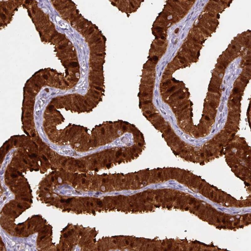 Annexin A1 Antibody (CL0199) - Azide and BSA Free Immunohistochemistry-Paraffin: Annexin A1 Antibody [NBP3-43928]