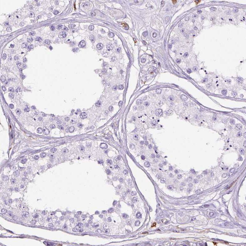 Annexin A1 Antibody (CL0199) - Azide and BSA Free Immunohistochemistry-Paraffin: Annexin A1 Antibody [NBP3-43928]