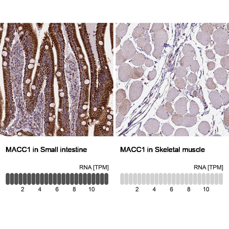 MACC1 Antibody (CL0856) - Azide and BSA Free Immunohistochemistry-Paraffin: MACC1 Antibody [NBP3-43929]