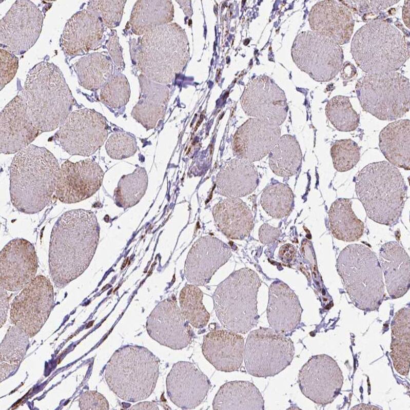 MACC1 Antibody (CL0856) - Azide and BSA Free Immunohistochemistry-Paraffin: MACC1 Antibody [NBP3-43929]