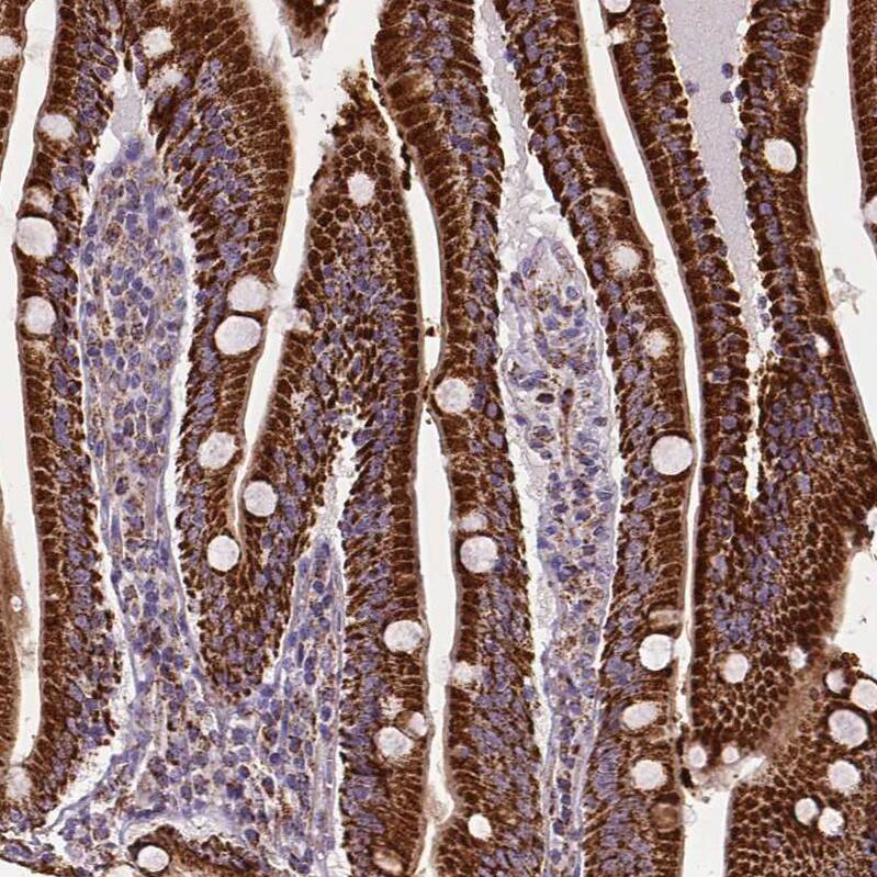 MACC1 Antibody (CL0856) - Azide and BSA Free Immunohistochemistry-Paraffin: MACC1 Antibody [NBP3-43929]